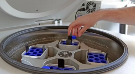 Conservation de la fertilité